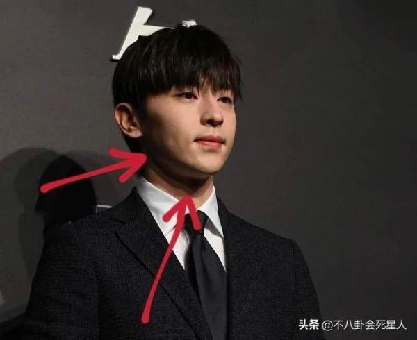 男星臉腫太可怕！顏值下滑十倍，王一博、鹿晗、李易峰紛紛中招