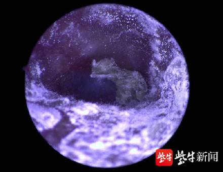 耳朵瘙癢當心裡面發黴 耳朵瘙癢當心裡面發黴