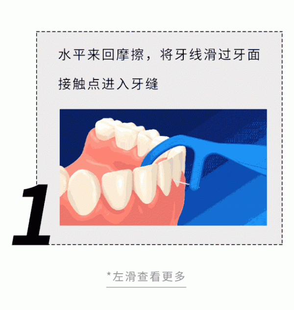 牙縫裡摳出的黃色物質到底是啥?為啥那麼臭 牙縫裡摳出的黃色物質到底是啥?為啥那麼臭