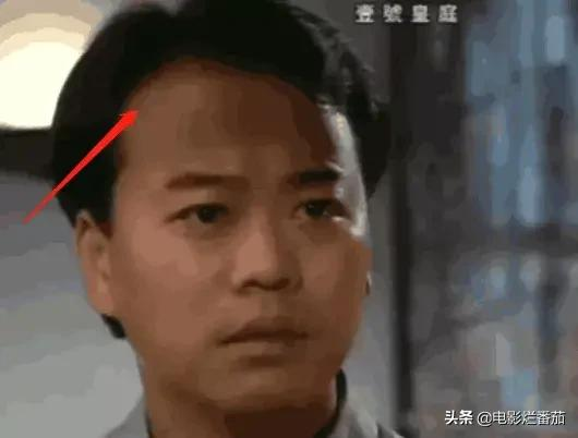 “禿頂”危機的10大男神，有人29歲髮際線堪憂，有人常年戴假髮套