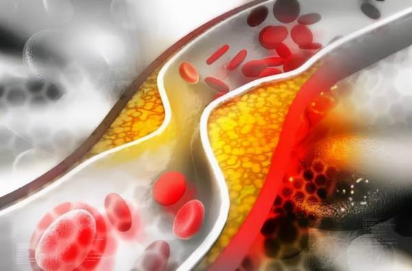 46歲杭州男子,每天堅持吃“六味地黃丸”,身體有哪些變化呢 46歲杭州男子,每天堅持吃“六味地黃丸”,身體有哪些變化呢