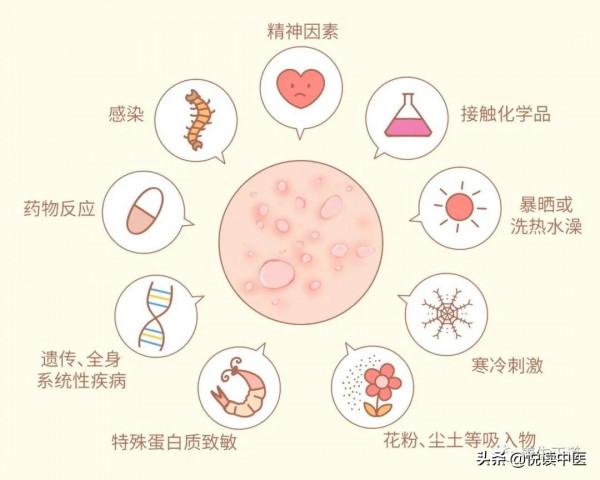過敏渾身瘙癢、紅腫、起疹子怎麼辦？
