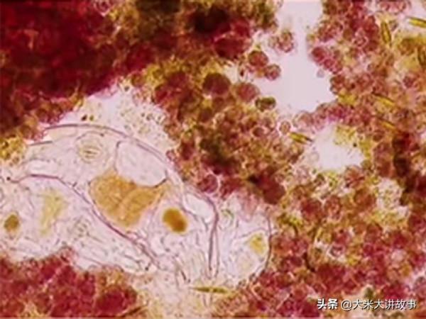 2.4萬年前輪蟲被複活，解凍後繁殖，科學家：有未知危險