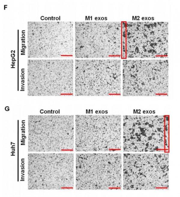 南京醫科大學第一附屬醫院的高分論文因大量細胞圖片重複遭質疑