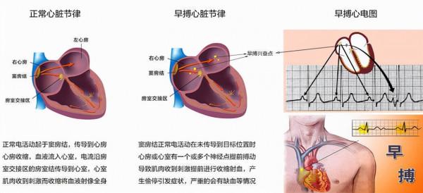 體檢時查出這4種病,醫生表示:基本不用治,不要自己嚇自己 體檢時查出這4種病,醫生表示:基本不用治,不要自己嚇自己