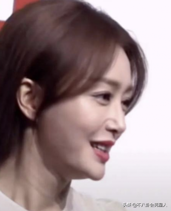 那些削骨的女星臉還好嗎？後遺症一大堆，楊冪鞠婧禕都開始崩了