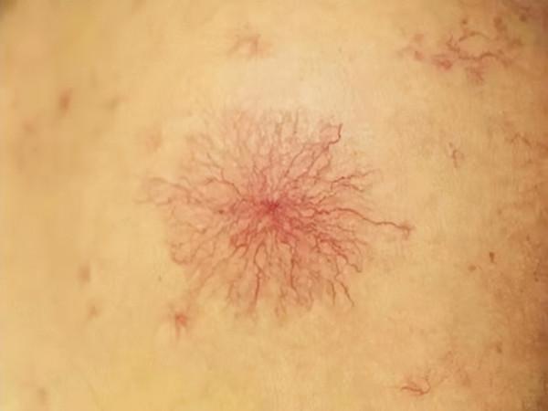 喜歡喝酒的人，身體反覆有4種情況，酒精肝或已找上門，趕緊戒