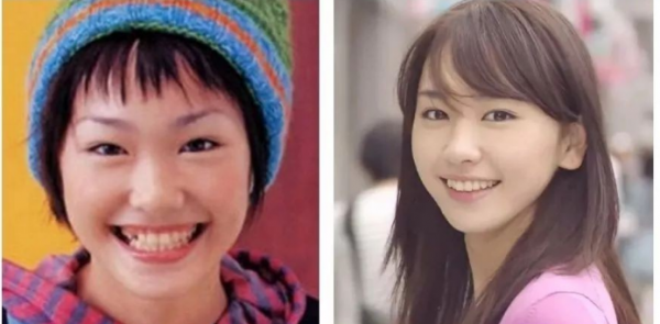 整容界的天花板!盤點靠整容實現逆天改命的明星 整容界的天花板!盤點靠整容實現逆天改命的明星