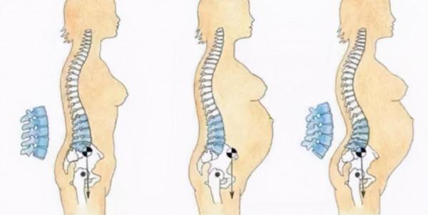 有一種痛叫“產後腰痛”,應採兒痛到哭,謝娜則需要安眠藥入睡 有一種痛叫“產後腰痛”,應採兒痛到哭,謝娜則需要安眠藥入睡