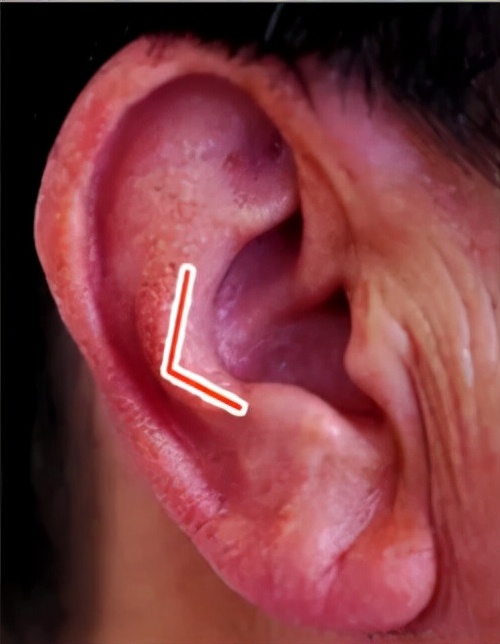 耳朵是身體的“長壽開關”每天揉一揉趕走小毛病