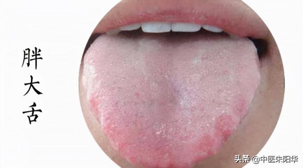 對鏡查舌早知病!中醫教您如何透過舌頭快速識別疾病 對鏡查舌早知病!中醫教您如何透過舌頭快速識別疾病