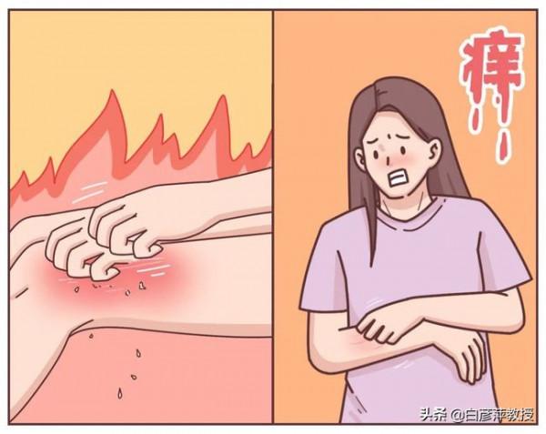 面板癢疹?又抓又撓,都無法控制的癢?或是癢疹在“作祟” 面板癢疹?又抓又撓,都無法控制的癢?或是癢疹在“作祟”