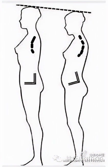 太極拳治含胸駝背頭前伸 太極拳治含胸駝背頭前伸
