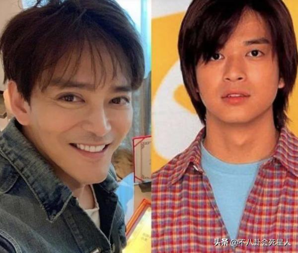 僵硬浮腫，像男芭比，中年男星動臉簡直是“災難現場”