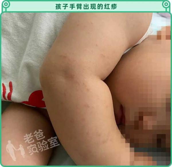 兩個孩子接連起紅疹,一張爬爬墊危害竟然這麼大? 兩個孩子接連起紅疹,一張爬爬墊危害竟然這麼大?