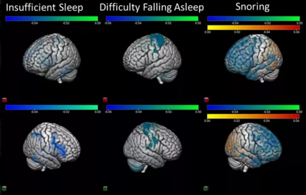 腦科學日報:睡眠不足,對大腦的傷害是毀滅性的 腦科學日報:睡眠不足,對大腦的傷害是毀滅性的