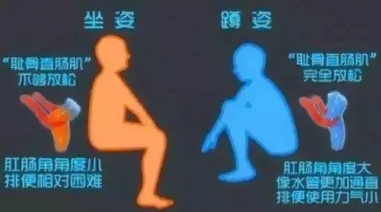 衛生間用蹲便,除了沒那麼高檔,用起來沒毛病啊,為什麼會被嘲笑 衛生間用蹲便,除了沒那麼高檔,用起來沒毛病啊,為什麼會被嘲笑