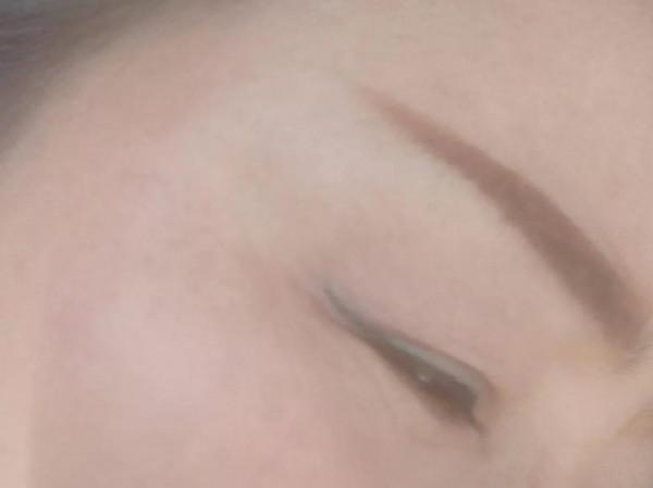 &quot;藥水點斑&quot;究竟好不好？點斑一年以後的我用真實的效果來告訴你