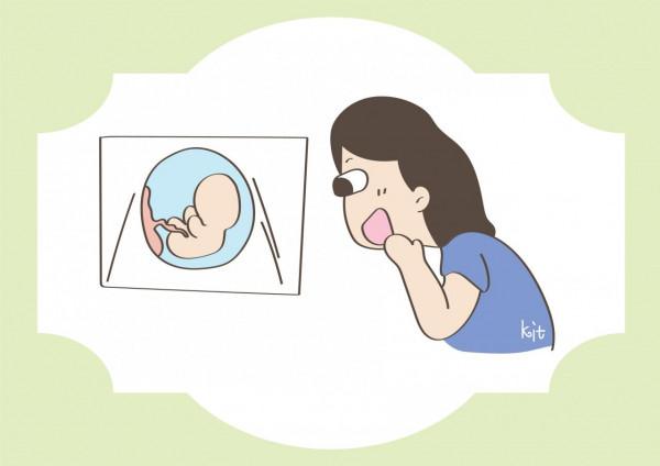 孕期去做B超,面板上被塗一層液體,這是什麼? 孕期去做B超,面板上被塗一層液體,這是什麼?