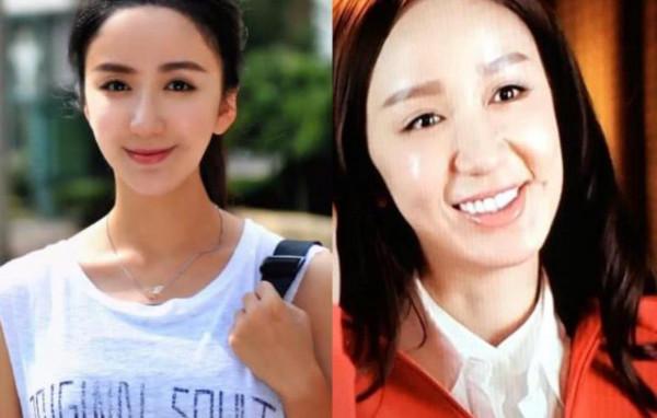 凹凸不平、眼睛擠成一條縫,“發麵饅頭”臉毀了多少高顏值明星? 凹凸不平、眼睛擠成一條縫,“發麵饅頭”臉毀了多少高顏值明星?