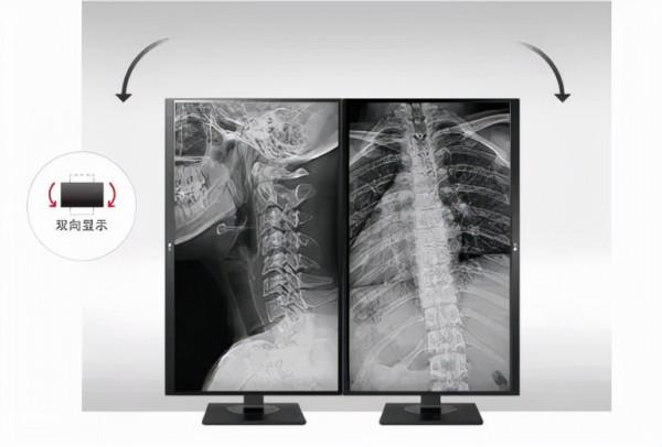 聯想和LG聯手！佈局醫學影像