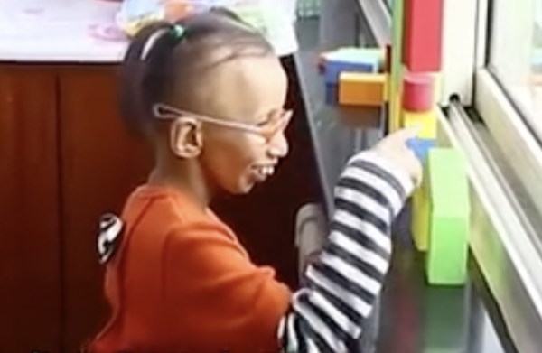 菲律賓16歲美少女,突然變成60歲老太太,顯得比母親還老,為啥? 菲律賓16歲美少女,突然變成60歲老太太,顯得比母親還老,為啥?