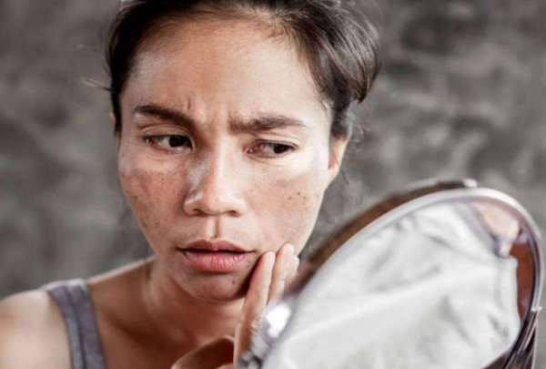 肝不好，臉先知嗎？提醒：肝臟受傷的人，臉上可能有4個&OpenCurlyDoubleQuote;標誌&rdquo;