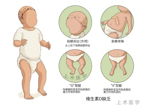 兒童天天服用維生素D有害嗎? 兒童天天服用維生素D有害嗎?