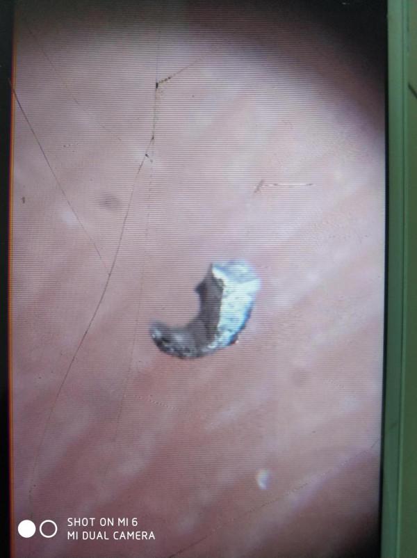 石隕石身上脫落的單質鐵鎳金屬顆粒形狀如何? 石隕石身上脫落的單質鐵鎳金屬顆粒形狀如何?