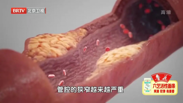 頭暈頭沉、反應力下降？可能是頸動脈出了大問題！2個檢查早發現