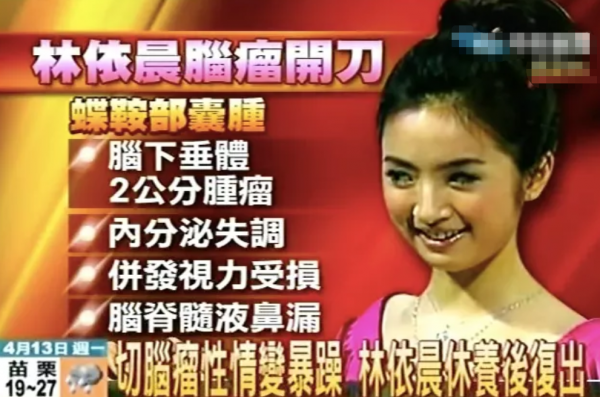 為還鉅債出道的10位明星,有2人還父母賭債,有5人因家裡生意失敗 為還鉅債出道的10位明星,有2人還父母賭債,有5人因家裡生意失敗