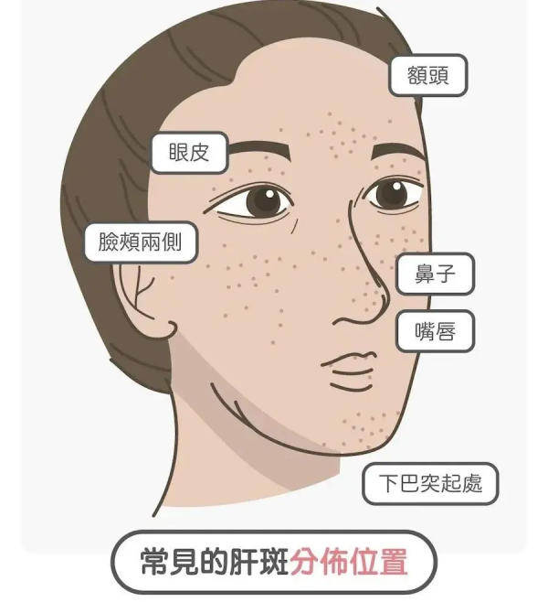 別踩雷啦,安全有效的美白淡斑攻略在這 別踩雷啦,安全有效的美白淡斑攻略在這