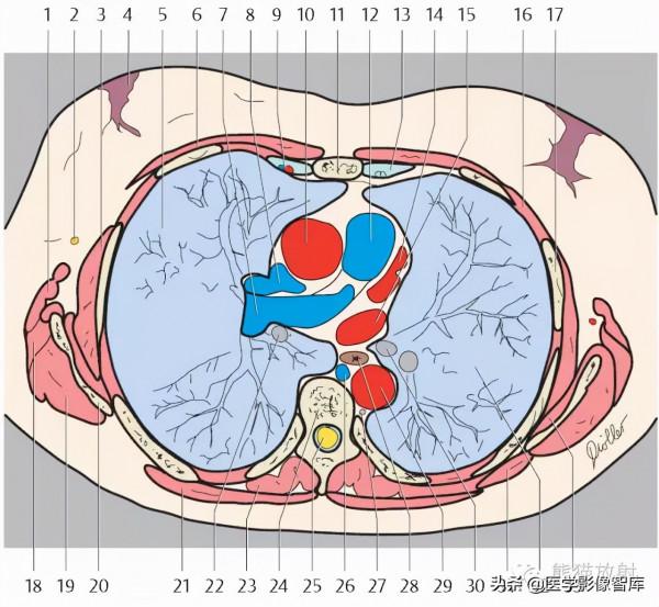 CT斷層解剖圖譜最全總結「推薦收藏」 CT斷層解剖圖譜最全總結「推薦收藏」