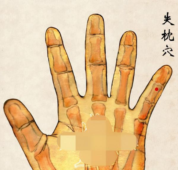 中醫針灸頸部疾病處方1