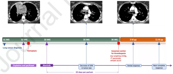懷孕期間服用靶向藥，會影響胎兒發育嗎？