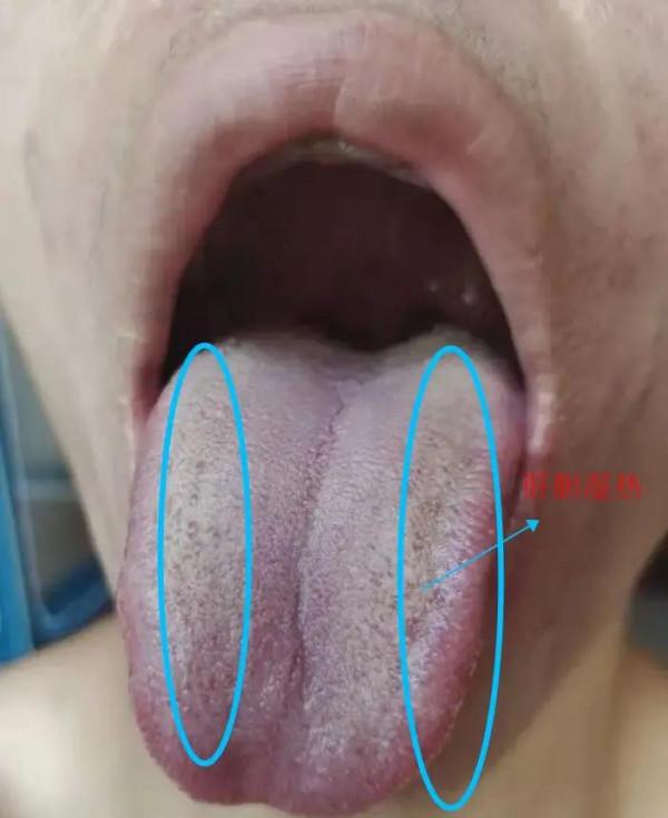 起床後總是口苦？是膽囊出了問題嗎？