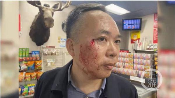 中國教授徒手擊退美國劫匪 同事:認識十多年了 沒想到他會功夫 中國教授徒手擊退美國劫匪 同事:認識十多年了 沒想到他會功夫