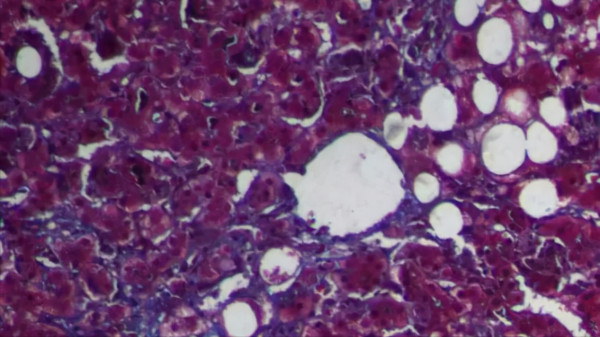 肝功能檢查單怎麼看？醫生：這3個指標正常，說明你的肝臟很健康