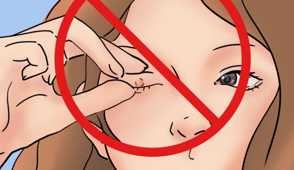 太心疼,9根睫毛毛囊藏著21條蟎蟲,10歲女童奇癢難耐拔光眼睫毛 太心疼,9根睫毛毛囊藏著21條蟎蟲,10歲女童奇癢難耐拔光眼睫毛