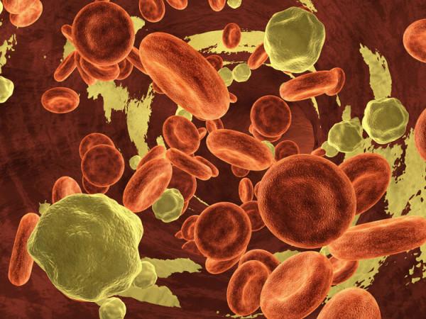 吃得清淡,為什麼膽固醇還是很高?提醒:堅持5個飲食原則很重要 吃得清淡,為什麼膽固醇還是很高?提醒:堅持5個飲食原則很重要