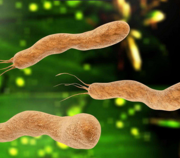 35歲男子頻繁胃痛，就醫查出幽門螺桿菌感染，醫生：儘量少碰3物