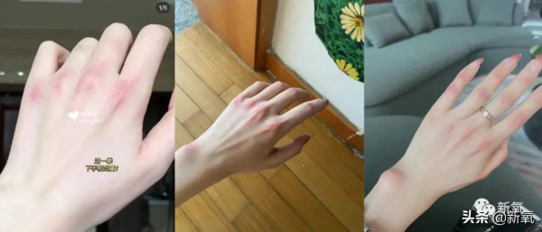 貴圈所謂的純欲天花板,就是在關節上打腮紅嗎? 貴圈所謂的純欲天花板,就是在關節上打腮紅嗎?