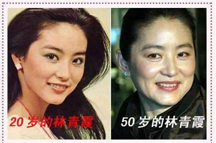 6位女星步入不惑之年,面容垮掉,膠原蛋白流失,彷彿整容失敗 6位女星步入不惑之年,面容垮掉,膠原蛋白流失,彷彿整容失敗