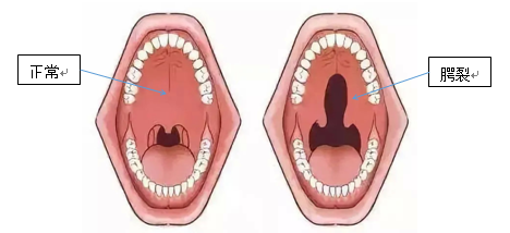 寶寶吐字不清、說話不清晰，寶爸寶媽們應該怎麼辦？
