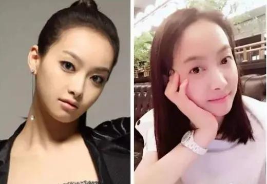 髮際線高又怎樣!盤點娛樂圈靠髮型照樣美貌的高發際線女星 髮際線高又怎樣!盤點娛樂圈靠髮型照樣美貌的高發際線女星