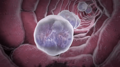 切爾諾貝利地下，形似象腳的熔燬爐芯，時隔多年為何可能會復燃？