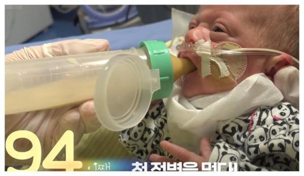 26周早產兒，出生不到1斤只有巴掌大，奇蹟生還長成大美人