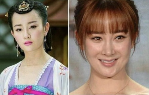 論整容的代價有多大，看看這些明星就知道，真是幾家歡喜幾家愁