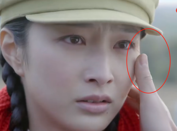 有人熱油澆臉不起泡，有人臉被燙熟創醫療奇蹟，國產劇毀容太離譜