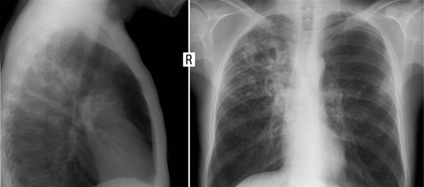 很多老菸民改抽“茶煙”,茶葉做的煙比香菸更健康?給您說清楚 很多老菸民改抽“茶煙”,茶葉做的煙比香菸更健康?給您說清楚